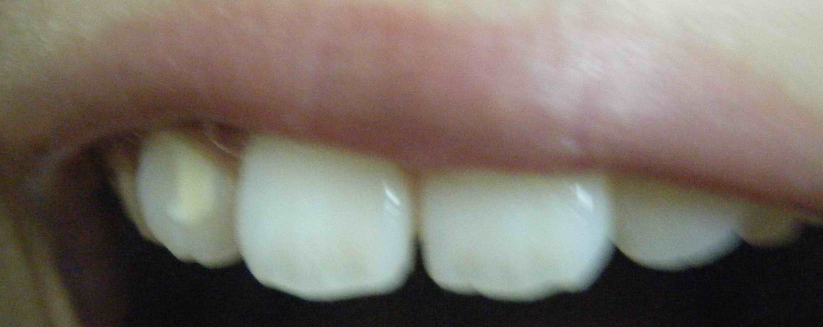 牙齿1.jpg