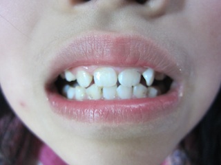 tooth2.jpg